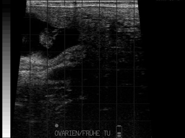 Fruehe Resorption